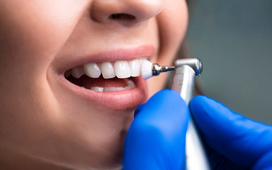 🦷 Este mayo, cuida tu sonrisa con nuestra promoción de Limpieza Dental + Radiografía ...
